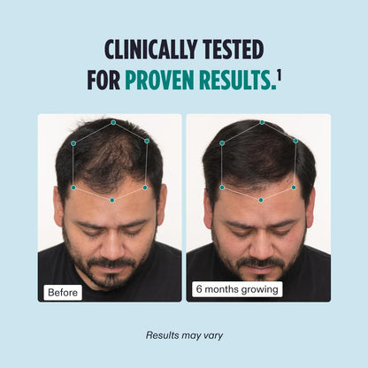 Nutrafol Men's Hair-3-Month Supply