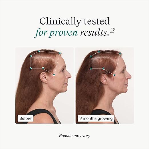 Nutrafol Women's Balance
